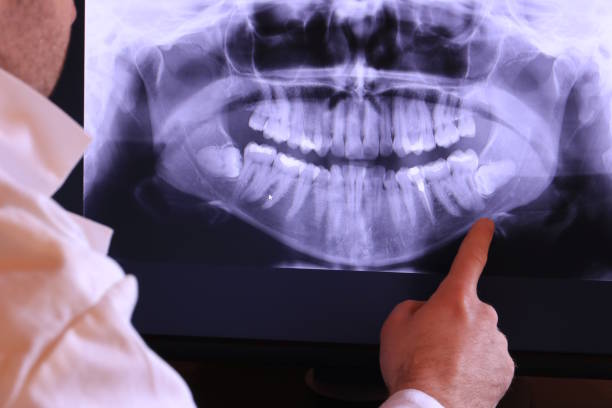 Best Broken or Cracked Tooth Emergency Dentist in Belfast, ME
