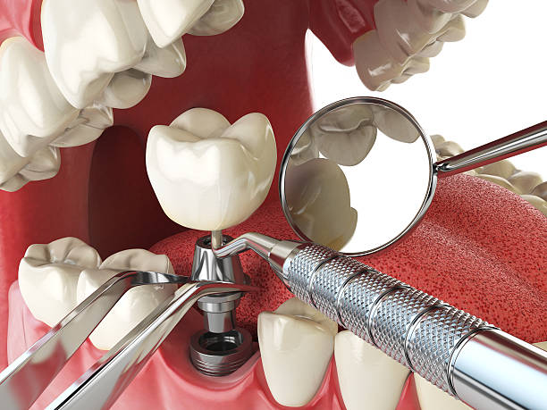 Best Emergency Dental Care for Abscessed Tooth in Belfast, ME