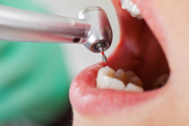 Best Emergency Dentist for Knocked-Out Tooth in Belfast, ME